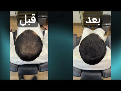خافي اثار الصلع من علامة باتشي العالمية